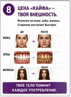 Плакат с заголовком «ЦЕНА "КАЙФА" — ТВОЯ ВНЕШНОСТЬ». На нём показано сравнение внешности «ДО» и «ПОСЛЕ» употребления наркотиков в трёх аспектах: кожа (появляются прыщи и покраснения), зубы (желтеют и разрушаются) и волосы (становятся тусклыми и редкими). Внизу фиолетовая плашка с текстом: «ТВОЕ ТЕЛО ПОМНИТ КАЖДОЕ УПОТРЕБЛЕНИЕ.»